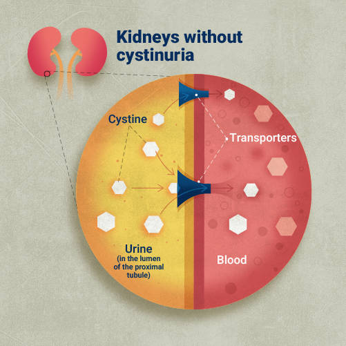Zoomed in picture of kidneys in a person who doesn’t have cystinuria showing  how cystine in the urine filters through the transporters of the kidney.